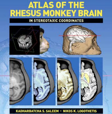 خرید و دانلود نسخه کامل کتاب A Combined MRI and Histology Atlas of the Rhesus Monkey Brain in Stereotaxic Coordinates
