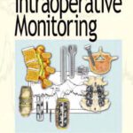 خرید و دانلود نسخه کامل کتاب A Concise Guide to Intraoperative Monitoring