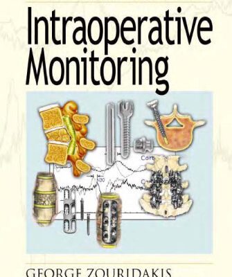 خرید و دانلود نسخه کامل کتاب A Concise Guide to Intraoperative Monitoring