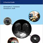خرید و دانلود نسخه کامل کتاب Abbreviated MRI of the Breast A Practical Guide
