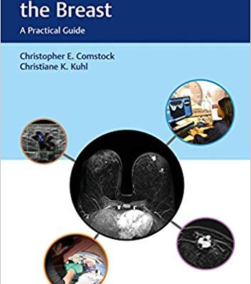 خرید و دانلود نسخه کامل کتاب Abbreviated MRI of the Breast A Practical Guide
