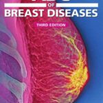خرید و دانلود نسخه کامل کتاب ABC of Breast Diseases, 3rd edition (ABC Series)