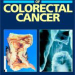 خرید و دانلود نسخه کامل کتاب ABC of Colorectal Cancer