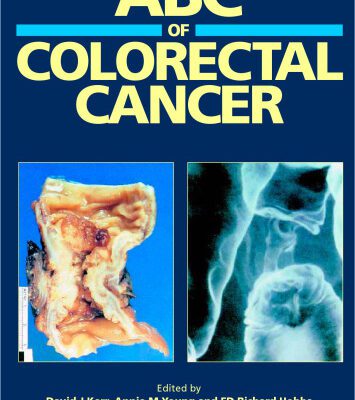 خرید و دانلود نسخه کامل کتاب ABC of Colorectal Cancer