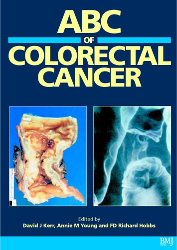 خرید و دانلود نسخه کامل کتاب ABC of Colorectal Cancer_68bb485a3e660.jpeg خرید و دانلود نسخه کامل کتاب ABC of Colorectal Cancer