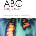 خرید و دانلود نسخه کامل کتاب ABC of Lung Cancer (ABC Series)