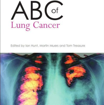 خرید و دانلود نسخه کامل کتاب ABC of Lung Cancer (ABC Series)