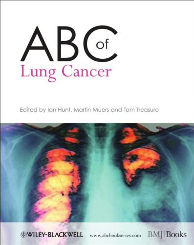 خرید و دانلود نسخه کامل کتاب ABC of Lung Cancer (ABC Series)_68bb289e09d38.jpeg خرید و دانلود نسخه کامل کتاب ABC of Lung Cancer (ABC Series)