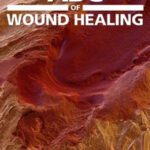خرید و دانلود نسخه کامل کتاب ABC of Wound Healing