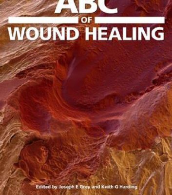 خرید و دانلود نسخه کامل کتاب ABC of Wound Healing