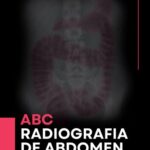 خرید و دانلود نسخه کامل کتاب ABC: Radiografía de Abdomen