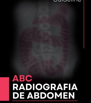 خرید و دانلود نسخه کامل کتاب ABC: Radiografía de Abdomen