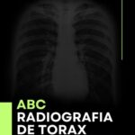 خرید و دانلود نسخه کامل کتاب ABC: Radiografía de Tórax