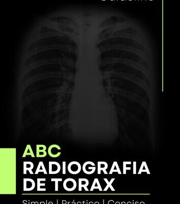 خرید و دانلود نسخه کامل کتاب ABC: Radiografía de Tórax