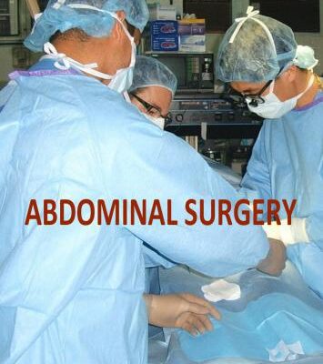 خرید و دانلود نسخه کامل کتاب Abdominal Surgery