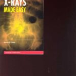 خرید و دانلود نسخه کامل کتاب ABDOMINAL X-RAYS MADE EASY