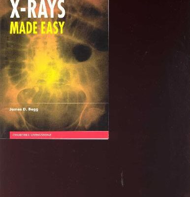 خرید و دانلود نسخه کامل کتاب ABDOMINAL X-RAYS MADE EASY