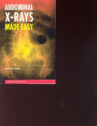 خرید و دانلود نسخه کامل کتاب ABDOMINAL X-RAYS MADE EASY_68bad9fdb223d.jpeg خرید و دانلود نسخه کامل کتاب ABDOMINAL X-RAYS MADE EASY