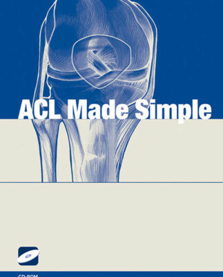 خرید و دانلود نسخه کامل کتاب ACL Made Simple