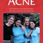 خرید و دانلود نسخه کامل کتاب Acne: The ‘At Your Fingertips’ Guide (At Your Fingertips) – Original PDF