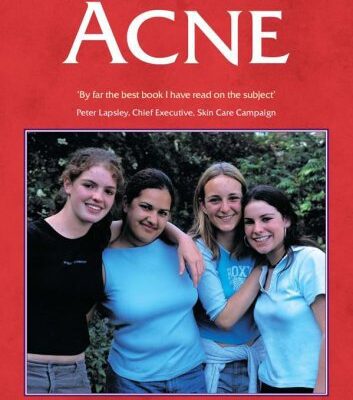 خرید و دانلود نسخه کامل کتاب Acne: The ‘At Your Fingertips’ Guide (At Your Fingertips) – Original PDF