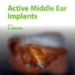 خرید و دانلود نسخه کامل کتاب Active Middle Ear Implants (Advances in Oto-Rhino-Laryngology, Vol. 69)