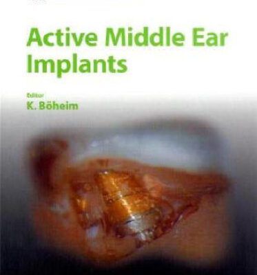 خرید و دانلود نسخه کامل کتاب Active Middle Ear Implants (Advances in Oto-Rhino-Laryngology, Vol. 69)