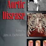 خرید و دانلود نسخه کامل کتاب Acute aortic disease