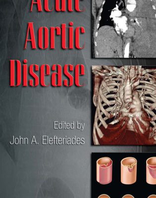 خرید و دانلود نسخه کامل کتاب Acute aortic disease