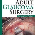 خرید و دانلود نسخه کامل کتاب Adult Glaucoma Surgery