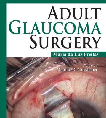 خرید و دانلود نسخه کامل کتاب Adult Glaucoma Surgery