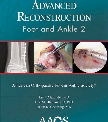 خرید و دانلود نسخه کامل کتاب Advanced Reconstruction: Foot and Ankle 2: Print + Ebook