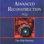 خرید و دانلود نسخه کامل کتاب Advanced Reconstruction Hip
