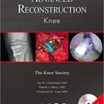 خرید و دانلود نسخه کامل کتاب Advanced Reconstruction: Knee