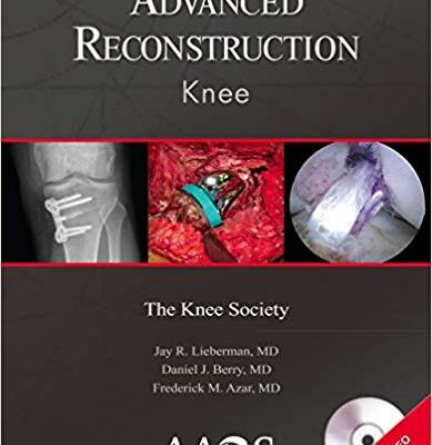 خرید و دانلود نسخه کامل کتاب Advanced Reconstruction: Knee