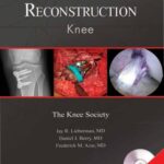 خرید و دانلود نسخه کامل کتاب Advanced Reconstruction: Knee