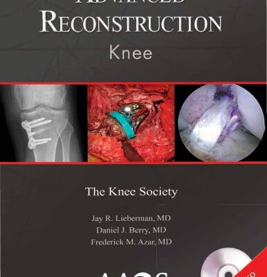 خرید و دانلود نسخه کامل کتاب Advanced Reconstruction: Knee