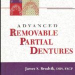 خرید و دانلود نسخه کامل کتاب Advanced Removable Partial Dentures