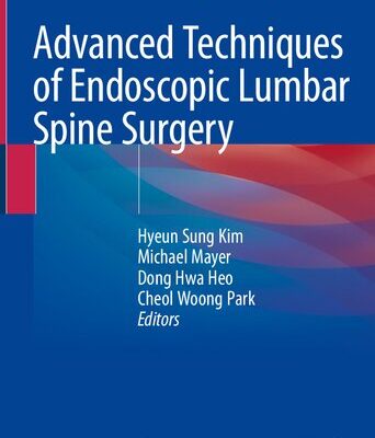 خرید و دانلود نسخه کامل کتاب Advanced Techniques of Endoscopic Lumbar Spine Surgery