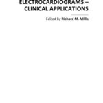 خرید و دانلود نسخه کامل کتاب Advances in Electrocardiograms – Clinical Applns.