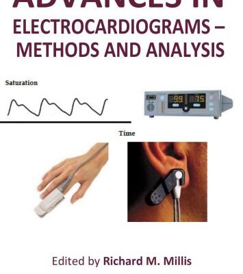 خرید و دانلود نسخه کامل کتاب Advances in Electrocardiograms: Methods and Analysis
