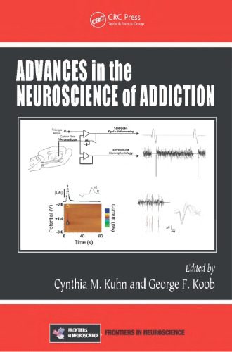 خرید و دانلود نسخه کامل کتاب Advances in the Neuroscience of Addiction (Frontiers in Neuroscience)_68bb5f2f5c9ab.jpeg خرید و دانلود نسخه کامل کتاب Advances in the Neuroscience of Addiction (Frontiers in Neuroscience)