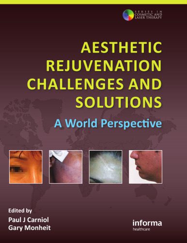 خرید و دانلود نسخه کامل کتاب Aesthetic Rejuvenation Challenges and Solutions: A World Perspective (Series in Cosmetic and Laser Therapy)_68beb7cc158b1.jpeg خرید و دانلود نسخه کامل کتاب Aesthetic Rejuvenation Challenges and Solutions: A World Perspective (Series in Cosmetic and Laser Therapy)