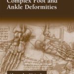خرید و دانلود نسخه کامل کتاب Alexander Kirienko Ilizarov Technique for Complex Foot and Ankle Deformities