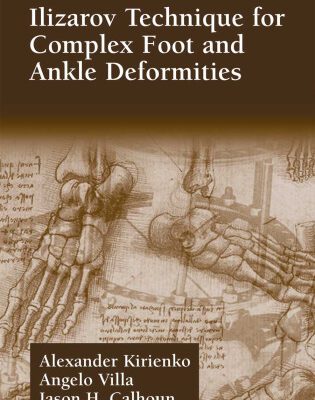 خرید و دانلود نسخه کامل کتاب Alexander Kirienko Ilizarov Technique for Complex Foot and Ankle Deformities