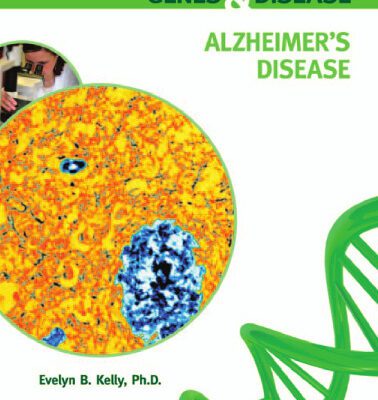 خرید و دانلود نسخه کامل کتاب Alzheimer’s Disease (Genes & Disease)