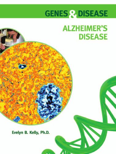 خرید و دانلود نسخه کامل کتاب Alzheimer’s Disease (Genes & Disease)_68b9876b400dd.jpeg خرید و دانلود نسخه کامل کتاب Alzheimer’s Disease (Genes & Disease)