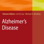 خرید و دانلود نسخه کامل کتاب Alzheimer’s Disease