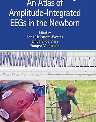 خرید و دانلود نسخه کامل کتاب An Atlas of Amplitude-Integrated EEGs in the Newborn (3rd Edition) – Orginal Pdf