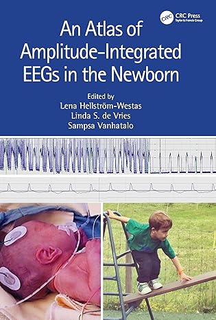 خرید و دانلود نسخه کامل کتاب An Atlas of Amplitude-Integrated EEGs in the Newborn (3rd Edition) – Orginal Pdf_68b90d80595f5.jpeg خرید و دانلود نسخه کامل کتاب An Atlas of Amplitude-Integrated EEGs in the Newborn (3rd Edition) – Orginal Pdf